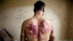 Siria, zonë vdekjeje
