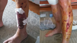 20 qen endacakë e kishin sulmuar Skender Nimanin, e mendoi edhe dorëzimin