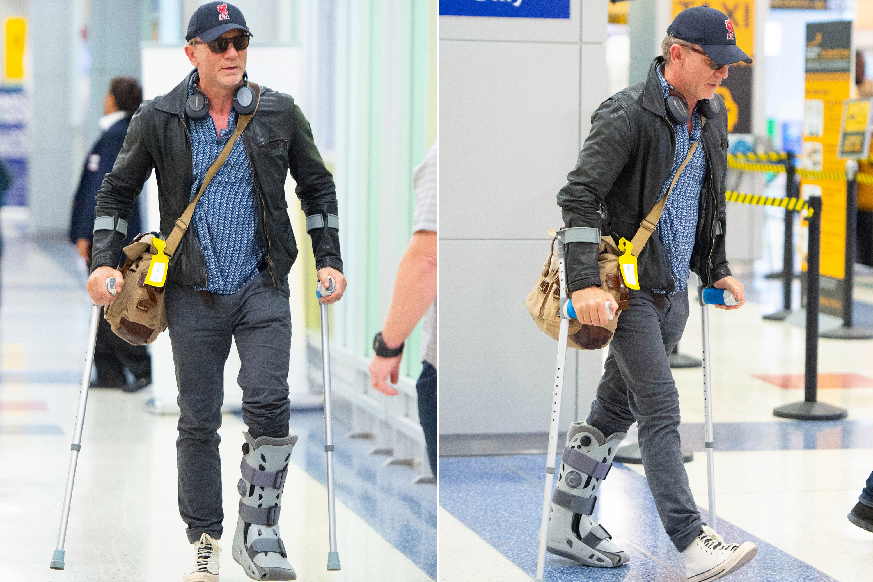Daniel Craig në paterica pas operimit të kyçit të këmbës