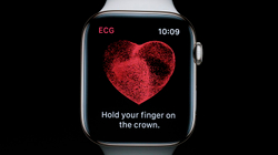 Përditësimi i ri i mundëson Apple Watchit të realizojë EKG-në