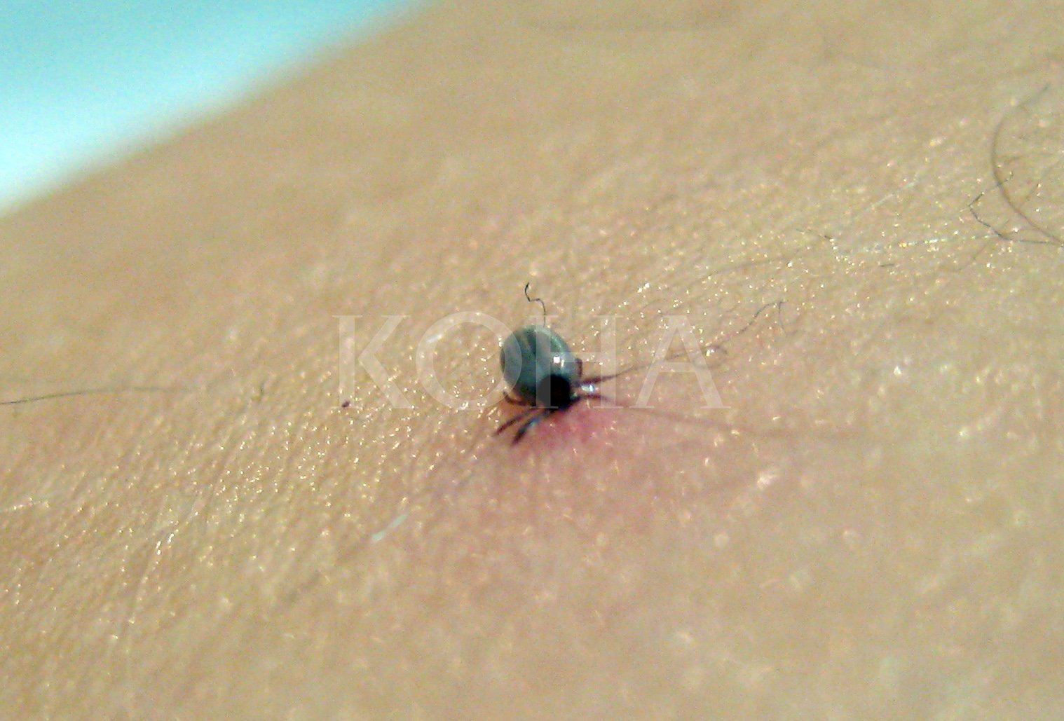 Foto: Alban Bujari / KD