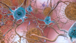 Zbulohet ”fitili ndezës” i Alzheimerit