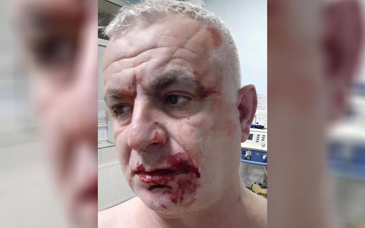 PDK-ja thotë se aktivistë të VV-së kanë sulmuar veprimtarin e kësaj partie në Ferizaj, Jakup Sabedinin