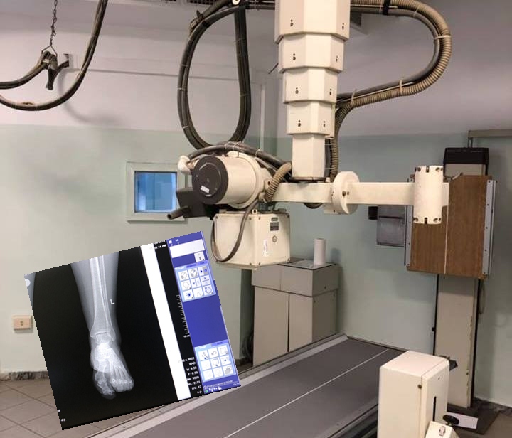 Spitali i Pejës digjitalizon shërbimet radiologjike