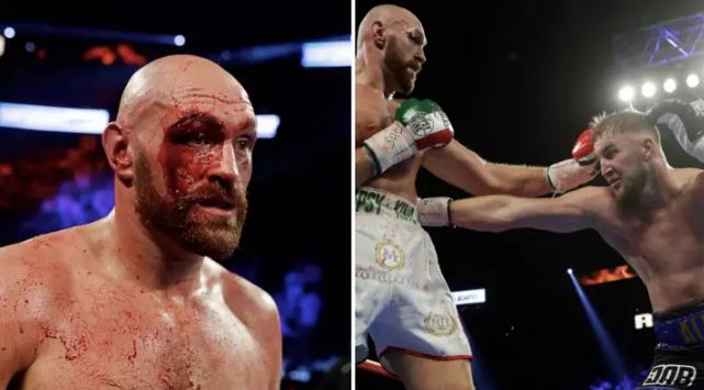 Me lëndim të rëndë Tyson Fury fiton meçin me Otto Wallinin