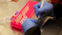 MSH-ja licencon edhe 11 laboratorë privatë për analiza të COVID-19, gjithsej 101