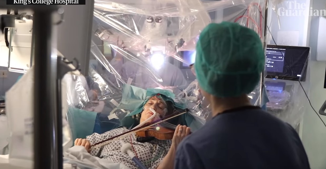 Muzikantja luan me violinë teksa mjekët i heqin tumorin nga truri