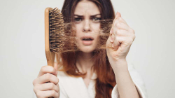 Mungesa e disa lëndëve ushqyese faktorë në rrallimin e flokëve