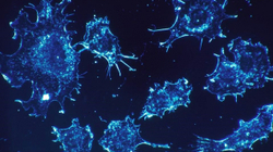 Nano grimcat e zbuluara vrasin kancerin pa kimioterapi si një 