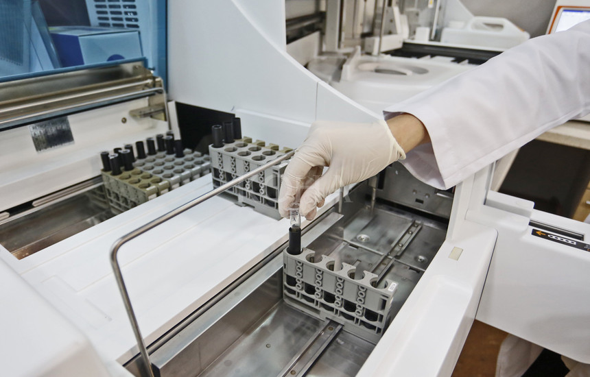 Foto: Driton Paçarada / KOHA