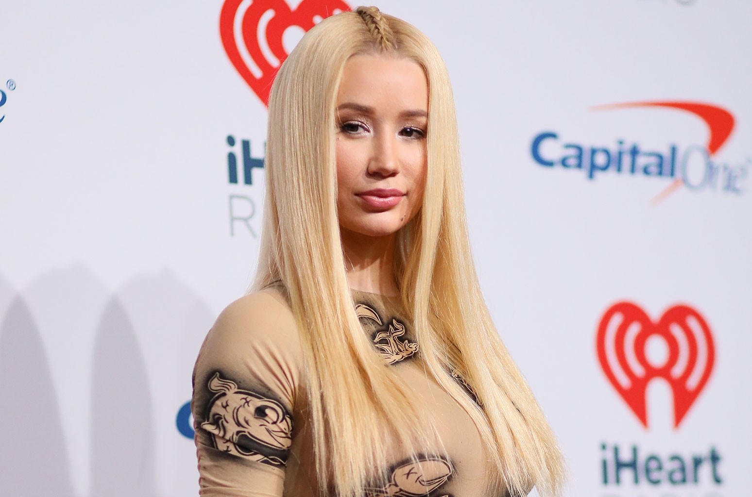 Iggy Azalea kishte menduar se do t’i duhej operacioni plastik pas lindjes së djalit
