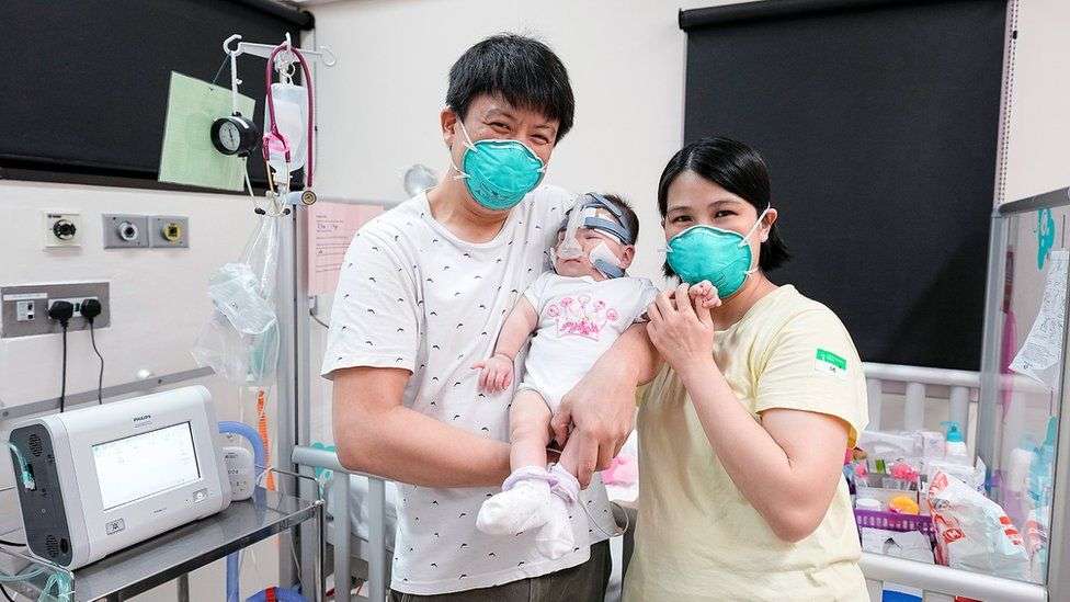 Foshnja më e vogël që ka lindur shkon në shtëpi pas 13 muajve në spital