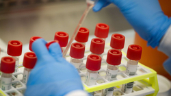 SHBA-ja në dispozicion 500 milionë teste të shpejta për variantin Omicron