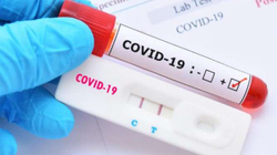 Anglia ndalon testet PCR për personat pa simptoma të COVID-19