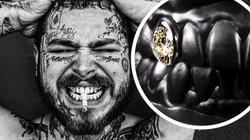 Post Malone bëhet me buzëqeshje 1 milion dollarëshe