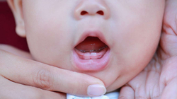 Medikamente natyrale për bebet që po u dalin dhëmbët