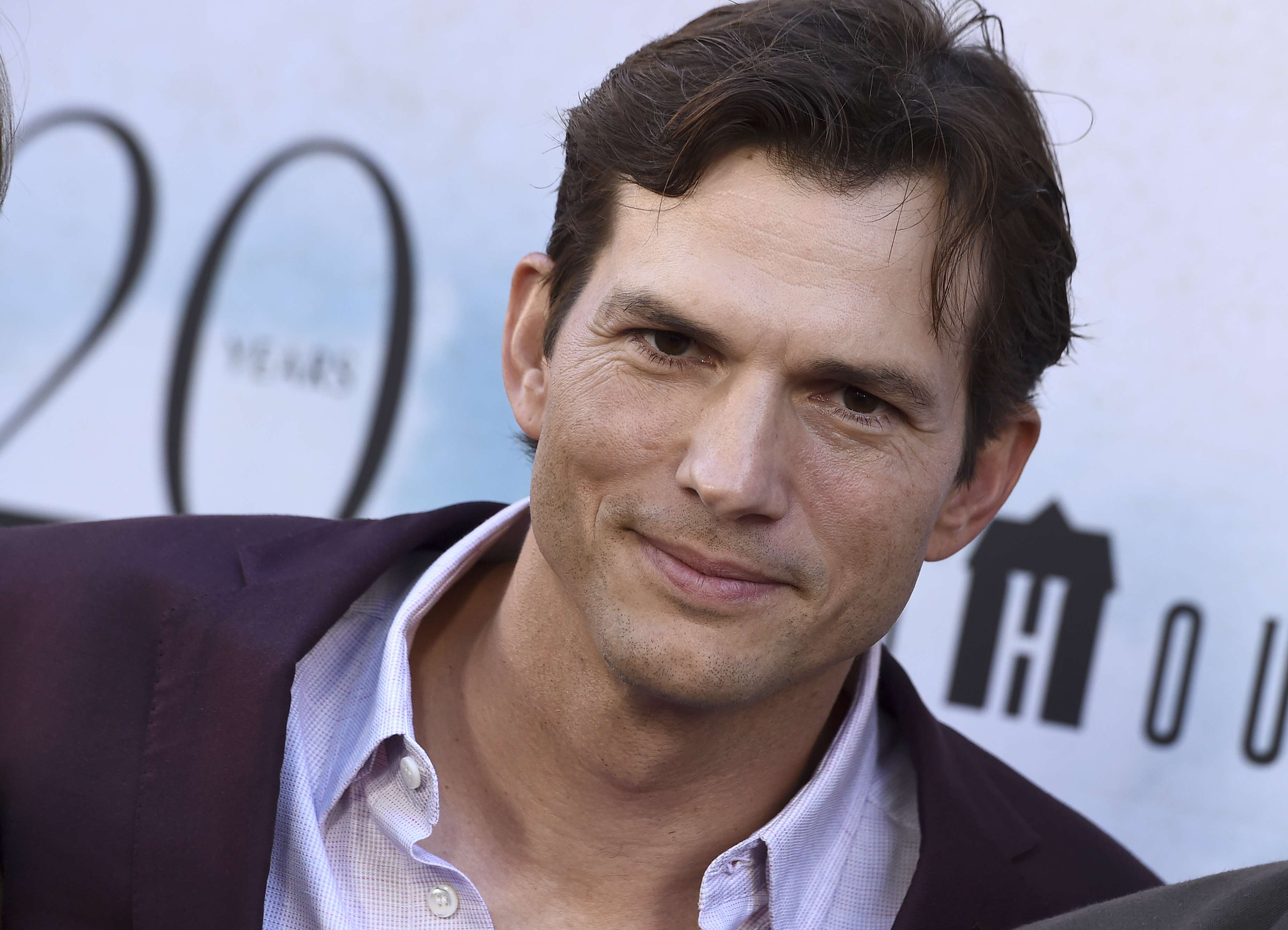 Ashton Kutcher e zbulon diagnozën me një sëmundje të rrallë
