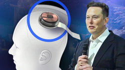 Çipat e trurit nga kompania e Elon Musk - miliarderi planifikon ta marrë një