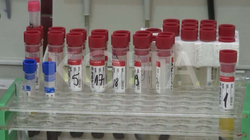 Shkencëtarët kinezë prezantojnë test të ri për koronavirus