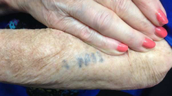 Shenjat për tatuazhe që thuhet se u përdorën në Auschwitz dalin të pavërteta
