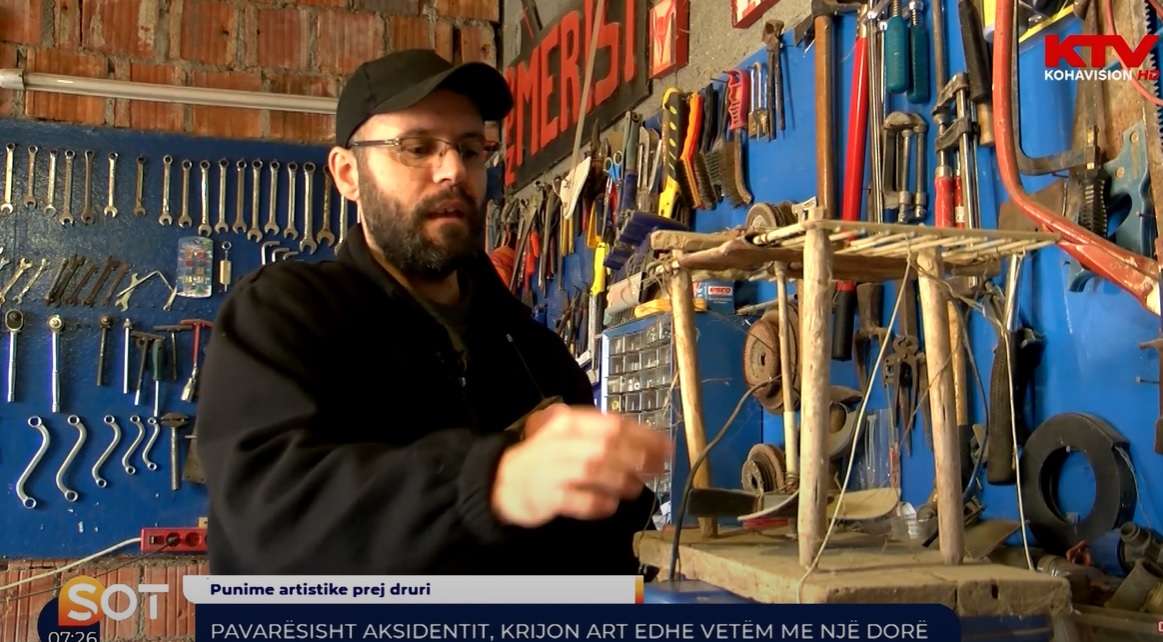 Pavarësisht aksidentit, krijon art edhe vetëm me një dorë