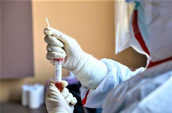 Katër të vdekur dhe 1.801 raste me COVID-19 në Shqipëri
