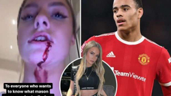 Ylli i Manchester Unitedit akuzohet nga e dashura për dhunë