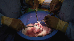 Transplantet me zemrën e derrit testohen në trupat e të vdekurve