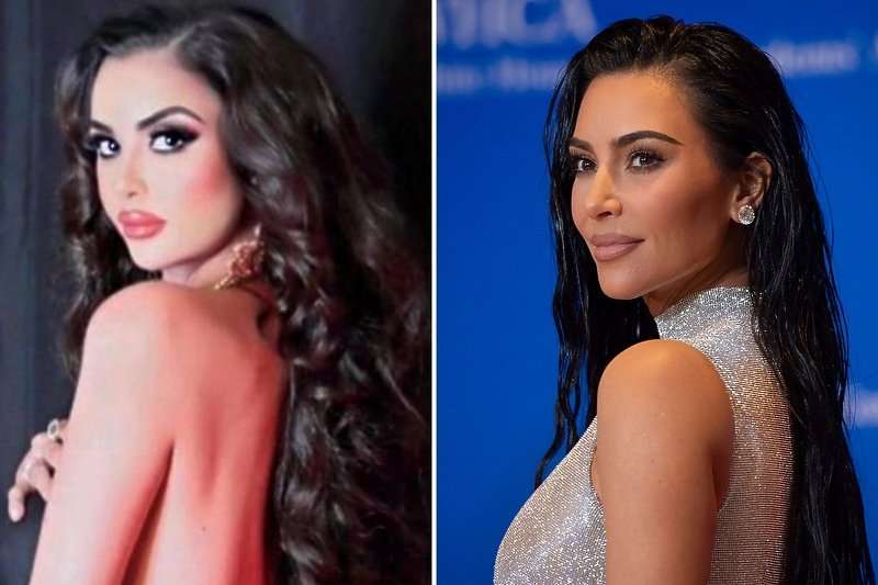 Modelja shpenzoi 600 mijë dollarë për t’u dukur si Kim Kardashian, por u pendua