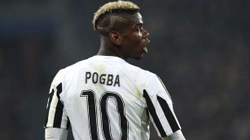 Operohet Pogba, nuk dihet sa do të mungojë