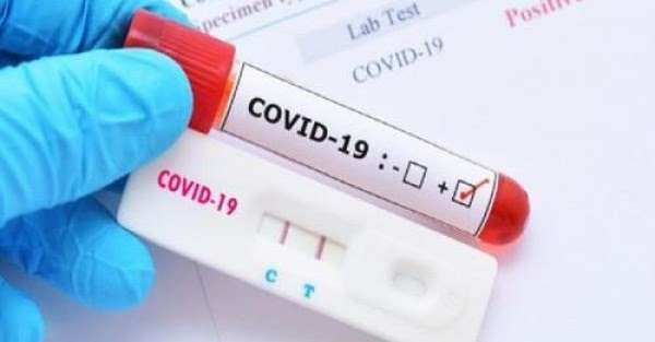 Një i vdekur nga COVID-19 të hënën në Shqipëri