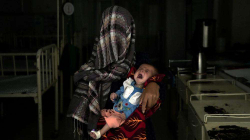 Përballja e 1.1 milionë fëmijëve afganë me kequshqyerje