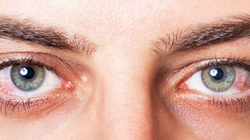 Si ndikon stresi i vazhdueshëm në shëndetin e syve 