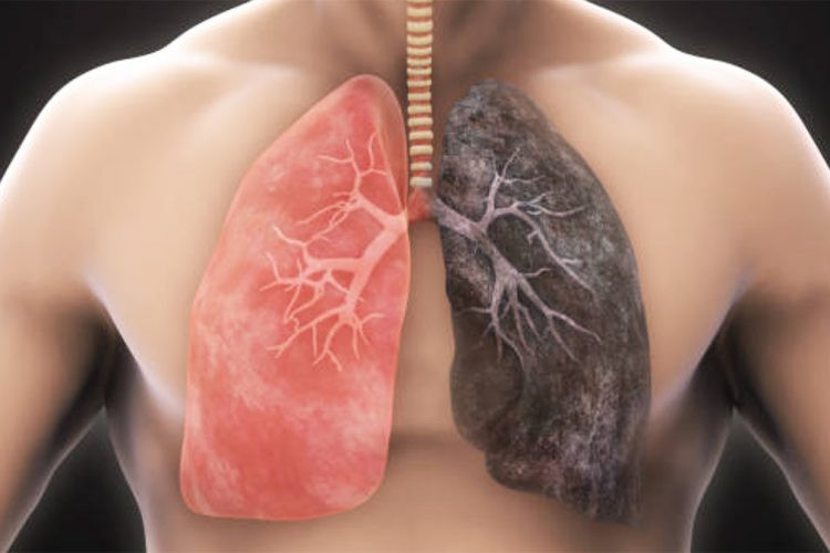 Comment nettoyer les poumons de la nicotine avec tout ce qui est naturel