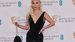 Fustanet e Lady Gagas do të ekspozohen në Pallatin Kensington