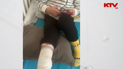 Fëmija 4-vjeçar pëson lëndime në këmbë nga sulmi brenda oborrit të çerdhes në Prishtinë