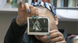Hungarezet detyrohen t’i dëgjojnë rrahjet e zemrës së fetusit përpara abortit