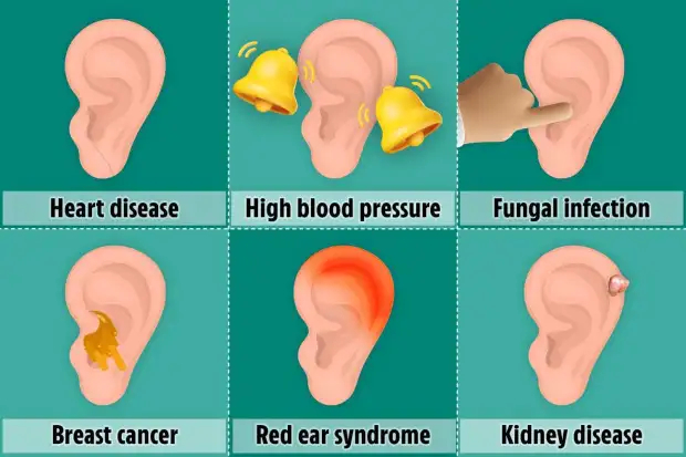 Qu'est-ce que l'oreille avertit sur la santé 