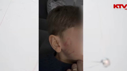 Një 4-vjeçar goditet me shuplakë nga një edukatore, në një kopsht privat në Mitrovicë