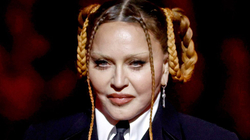Madonna ndjehet me fat që është gjallë