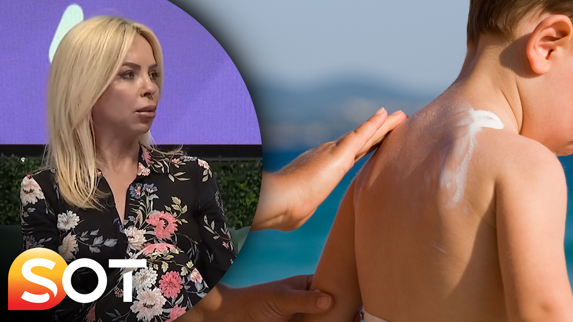 Kujdesi ndaj lëkurës së fëmijëve gjatë ekspozimit në diell