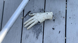 Qytetarët gjetën një “dorë të dyshimtë”, doli të ishte e kukullës