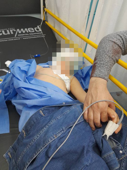 Kafshohet nga qentë endacakë një 5-vjeçar në Milloshevë