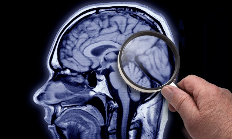 10-zakone-per-ta-mbrojtur-shendetin-e-trurit