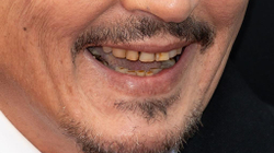 Dhëmbët e “kalbur” të Johnny Depp neveritin fansat