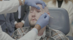 SHBA, kryhet transplantimi i parë i syrit në botë