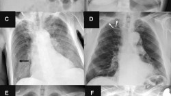 Radiologët më të saktë se Inteligjenca artificiale në identifikimin e sëmundjeve”