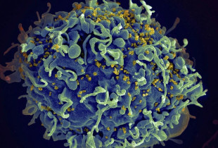 Dokumentohet për herë të parë transmetimi i virusit HIV përmes gjilpërave që përdoren për tretmanin "vampir" të fytyrës