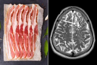 Efeketi i mishit të papjekur të derrit