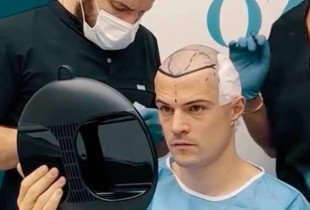 Granit Xhaka